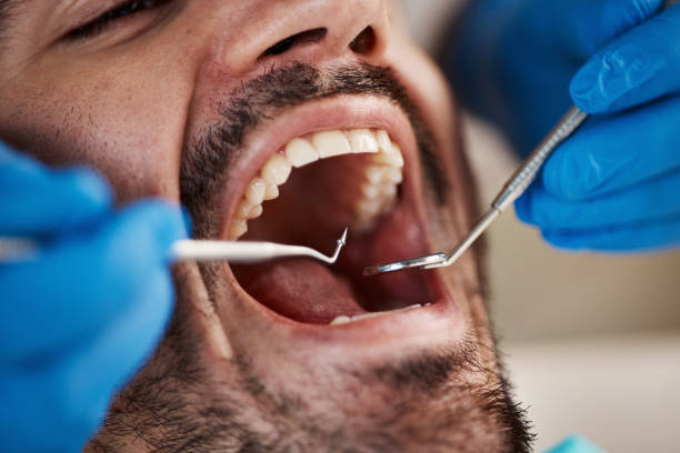 Best Emergency Broken Tooth Repair in Swartz Creek, MI